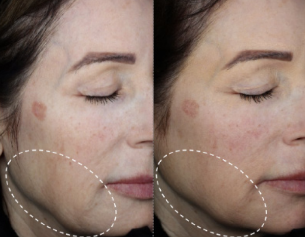 Jowls - Exosomes
