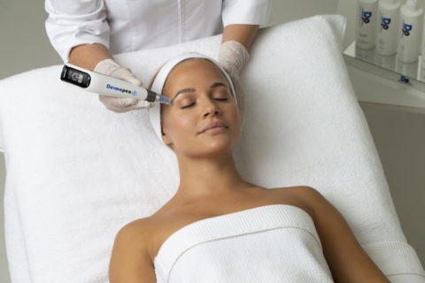 Microneedling