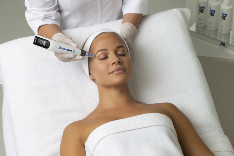 Microneedling