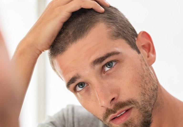 POLYNUCLEOTIDES FOR HAIR LOSS: A REGENERATIVE SOLUTION