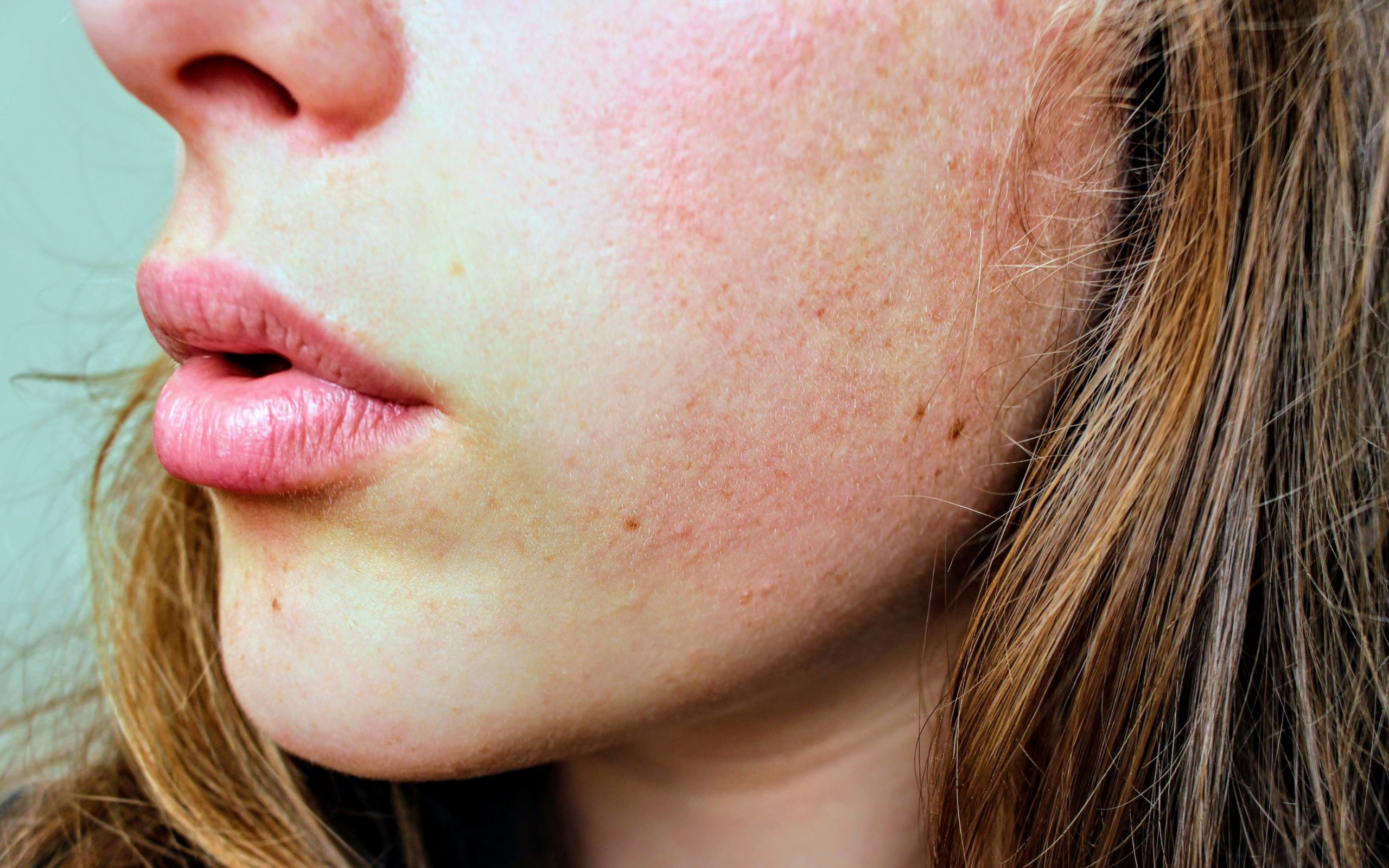 INTERNATIONAL SKIN PIGMENTATION DAY: UNDERSTANDING & TREATING UNEVEN SKIN TONE