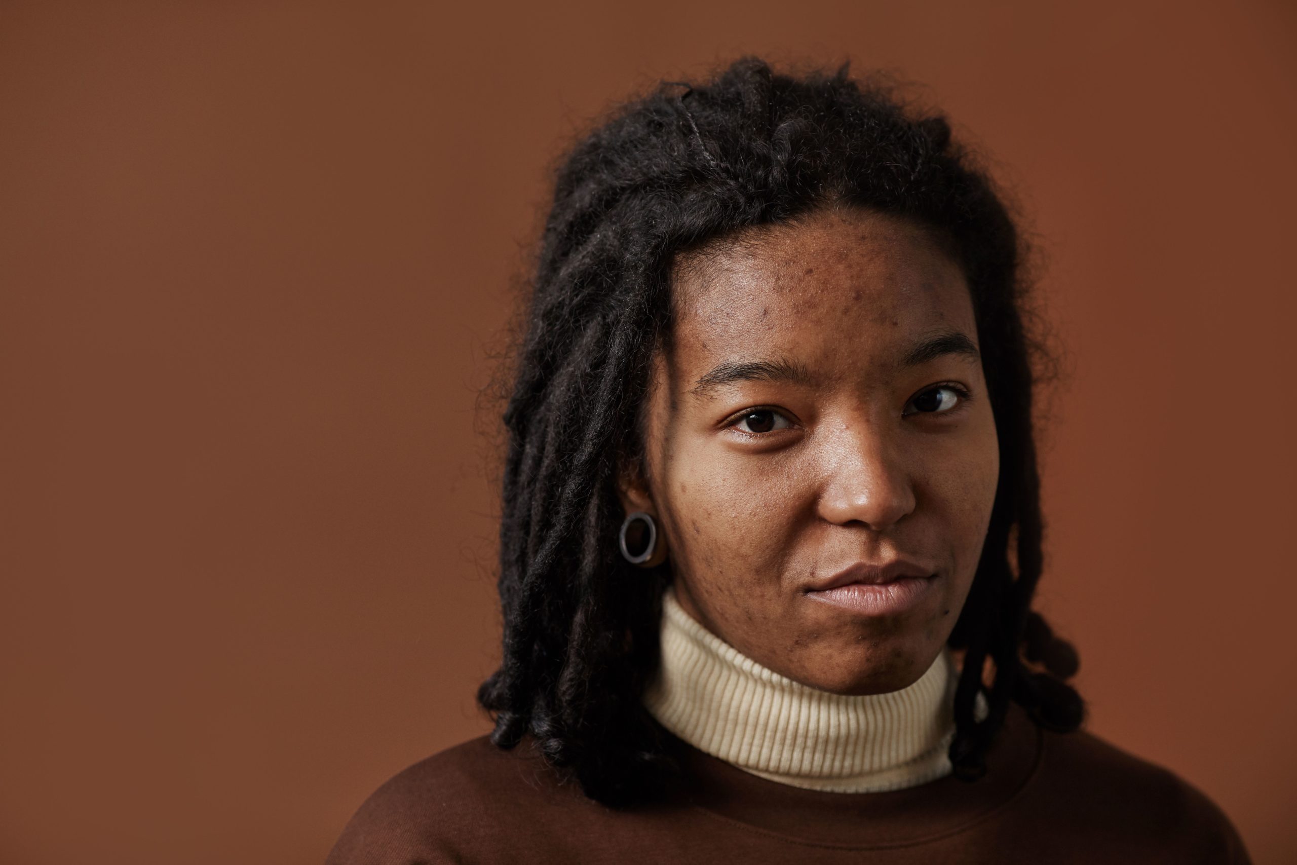ACNE AWARENESS MONTH: WHAT YOU NEED TO KNOW ABOUT ACNE AND HOW TO TREAT IT PROPERLY